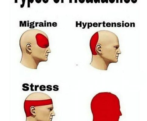Types of Headaches meme