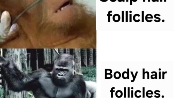Hair follicles